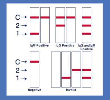 covid-19 test